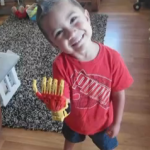 3 Year Old Boy Given Iron Man Hand